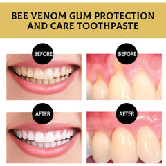 Bee Poison Gum Care Toothpaste To Remove Yellow And Oral Odor